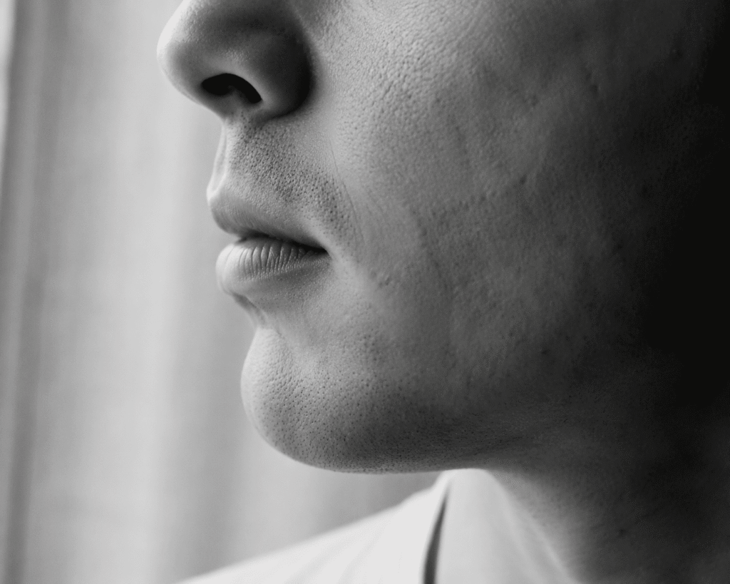 How to Get Rid of Mustache Shadow After Shaving: 7 Fixes That Actually Work